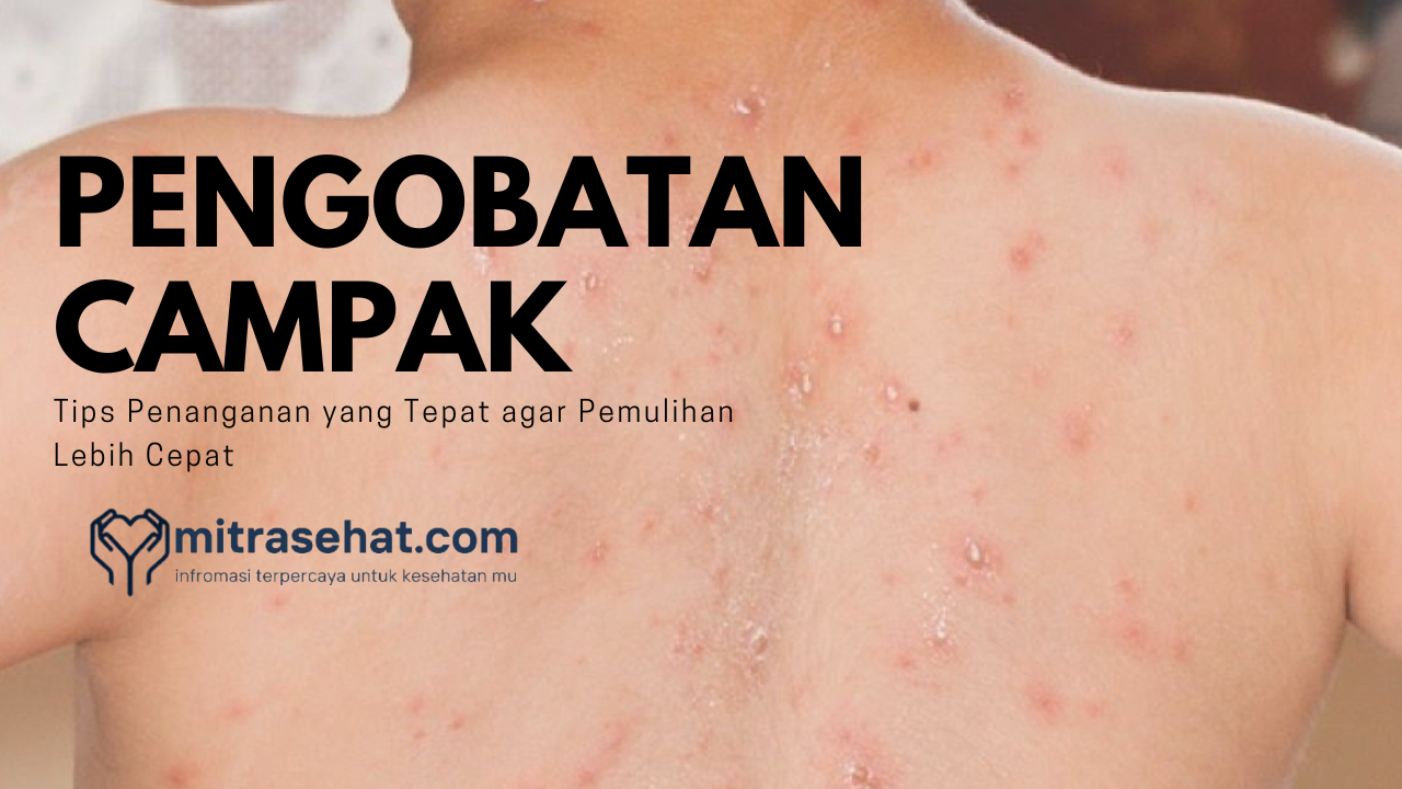 Tips Penanganan yang Tepat agar Pemulihan Lebih Cepat
